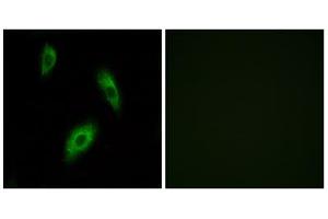 Immunofluorescence analysis of LOVO cells, using GPR174 antibody. (GPR174 anticorps  (Internal Region))