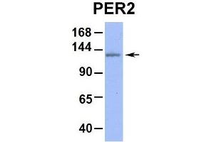 Host:  Rabbit  Target Name:  PER2  Sample Type:  Human Jurkat  Antibody Dilution:  1.
