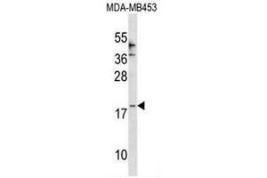 CCL25 Antibody (Center) western blot analysis in MDA-MB453 cell line lysates (35µg/lane). (CCL25 anticorps  (Middle Region))