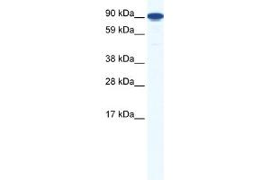WB Suggested Anti-ZFY1 Antibody Titration:  1. (ZFY1 anticorps  (Middle Region))
