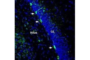 Expression of Zinc transporter ZIP8 in rat hippocampus - Immunohistochemical staining of perfusion-fixed frozen rat brain sections with Anti-ZIP8 (SLC39A8) (extracellular) Antibody (ABIN7043726, ABIN7045350 and ABIN7045351), (1:200), followed by goat-anti-rabbit-AlexaFluor-488.