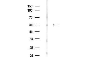 Western blot analysis of lysates from COLO205 cells(UV 30 min treatment), using Phospho-HNF4 alpha (Ser304) Antibody at 1/1000 dilution.