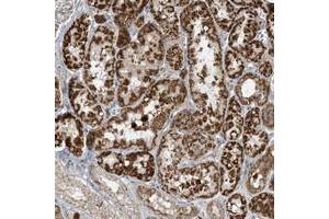 Immunohistochemical staining of human kidney with HPDL polyclonal antibody  shows strong cytoplasmic positivity in cells in tubule.