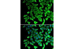 Immunofluorescence analysis of  cells using PTGES2 antibody (ABIN6129084, ABIN6146403, ABIN6146405 and ABIN6217438). (PTGES2 anticorps  (AA 88-377))