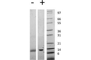 SDS-PAGE of Human Galectin-1 Recombinant Protein SDS-PAGE of Human Galectin-1 Recombinant Protein.