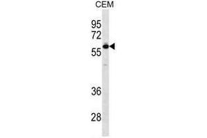 TBX5 Antibody (N-term) western blot analysis in CEM cell line lysates (35ug/lane).