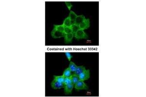ICC/IF Image Immunofluorescence analysis of methanol-fixed A431, using DOCK1/180, antibody at 1:200 dilution. (DOCK1 anticorps  (C-Term))