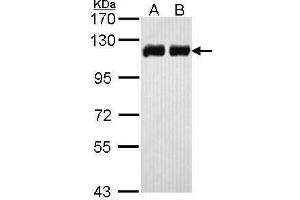 WB Image Sample (30 ug of whole cell lysate) A: H1299 B: Hela 7. (KAP1 anticorps)