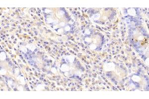 Detection of GNb2 in Human Small intestine Tissue using Polyclonal Antibody to G Protein Beta 2 (GNb2)