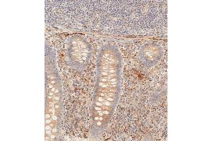 Immunohistochemical analysis of paraffin-embedded human epityphlon tissue using (ABIN392563 and ABIN2842106) performed on the Leica® BOND RXm. (PIK3CD anticorps  (C-Term))