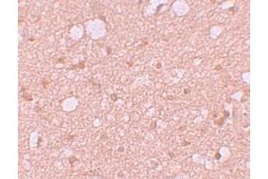 Immunohistochemical staining of human brain cells with SESTD1 polyclonal antibody  at 5 ug/mL.