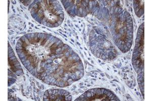 Image no. 2 for anti-SERPINE1 mRNA Binding Protein 1 (SERBP1) (AA 1-262) antibody (ABIN1490678)