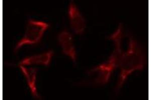 ABIN6275328 staining K562 by IF/ICC. (NOC3L anticorps  (Internal Region))