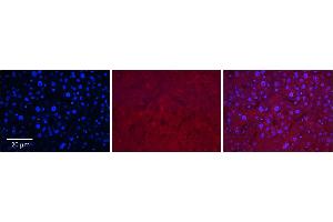 Rabbit Anti-SLC37A4 Antibody      Formalin Fixed Paraffin Embedded Tissue: Human Adult Liver   Observed Staining: Cytoplasm in hepatocytes, weak signal, low tissue distribution   Primary Antibody Concentration: 1:100  Secondary Antibody: Donkey anti-Rabbit-Cy3  Secondary Antibody Concentration: 1:200  Magnification: 20X  Exposure Time: 0.