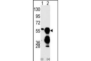 Western blot analysis of M1F (arrow) using M1F Antibody (C-term) (ABIN392884 and ABIN2842288). (PPM1F anticorps  (C-Term))