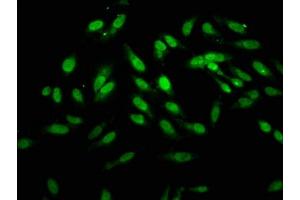 Immunofluorescence staining of Hela cells with ABIN7155739 at 1:166, counter-stained with DAPI. (HOXB4 anticorps  (AA 88-166))