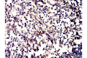 Immunohistochemical analysis of paraffin-embedded tonsil tissues using CD11a mouse mAb with DAB staining. (ITGAL anticorps  (AA 26-194))