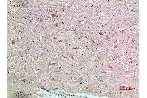 Immunohistochemical analysis of paraffin-embedded human-brain, antibody was diluted at 1:200