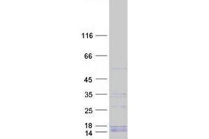 Validation with Western Blot