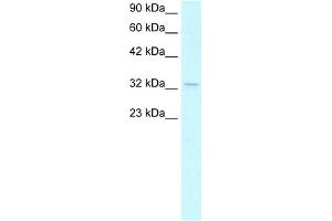 WB Suggested Anti-NPM1 Antibody Titration:  1. (NPM1 anticorps  (C-Term))