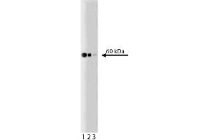 Western blot analysis of Hsp60 on a Jurkat lysate (ABIN968537). (HSPD1 anticorps)