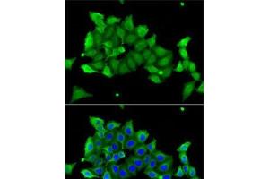 Immunofluorescence analysis of A-549 cells using CA1 Polyclonal Antibody (CA1 anticorps)