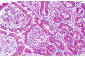 Image no. 2 for anti-5'-Nucleotidase, Ecto (CD73) (NT5E) (AA 433-482) antibody (ABIN1492672)