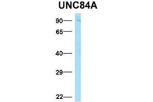 Host:  Rabbit  Target Name:  UNC84A  Sample Type:  Human Adult Placenta  Antibody Dilution:  1.