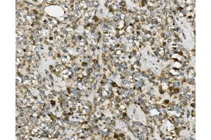 IHC analysis of TRIM25 using anti-TRIM25 antibody (ABIN7599495). (TRIM25 anticorps  (AA 1-610))