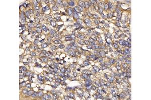 IHC analysis of IFIT5 using anti-IFIT5 antibody (ABIN7600752). (IFIT5 anticorps  (AA 23-439))