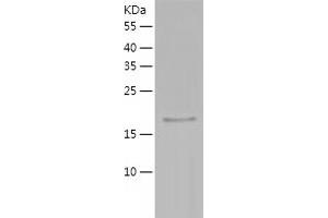 Interleukin 10 (IL10) (AA 19-178) (Active) protein (His tag)