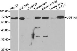 Western blot analysis of extracts of various cell lines, using μgT1A1 antibody (ABIN5973637) at 1/1000 dilution. (UGT1A1 anticorps)