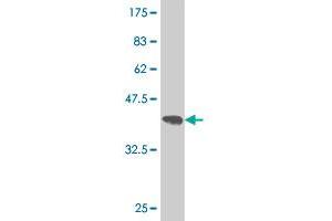 Western Blot detection against Immunogen (37.