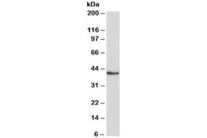 Western blot testing of K562 lysate with HMBS antibody at 0. (HMBS anticorps)