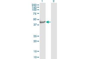 Western Blot analysis of NPTX1 expression in transfected 293T cell line by NPTX1 monoclonal antibody (M06), clone 7E6.