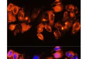 Immunofluorescence analysis of HeLa cells using IGFBP5 Polyclonal Antibody at dilution of 1:100. (IGFBP5 anticorps)