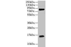 Western blot All lanes: Hemoglobin polyclonal antibody at 2 μg/mL + 293T whole cell lysate Secondary Goat polyclonal to rabbit IgG at 1/15000 dilution Predicted band size: 16 kDa Observed band size: 16 kDa (Hemoglobin anticorps)