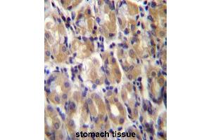 TOR1B Antibody (C-term) immunohistochemistry analysis in formalin fixed and paraffin embedded human stomach tissue followed by peroxidase conjugation of the secondary antibody and DAB staining. (TOR1B anticorps  (C-Term))