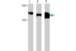 Western blot analysis of extract from Myc-CIBZ protein (lane 1) , mouse brain tissue (lane 2) and mouse kidney tissue (lane 3) , using Zbtb38 polyclonal antibody  . (ZBTB38 anticorps)