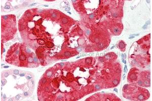 Rabbit Anti-ALDOB antibody  Formalin Fixed Paraffin Embedded Tissue: Human Adult Kidney  Observed Staining: Cytoplasm in hepatocytes Primary Antibody Concentration: 1:600 Secondary Antibody: Donkey anti-Rabbit-Cy3 Secondary Antibody Concentration: 1:200 Magnification: 20X Exposure Time: 0.