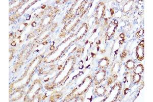 Immunohistochemistry of paraffin-embedded mouse kidney using ACADM Rabbit mAb (ABIN1678538, ABIN3019056, ABIN3019057 and ABIN7101707) at dilution of 1:100 (40x lens).