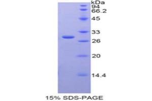SDS-PAGE analysis of Rat GAL3ST1 Protein. (GAL3ST1 Protéine)