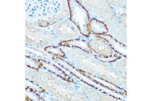 Immunohistochemistry of paraffin-embedded mouse kidney using H Rabbit pAb (ABIN6131125, ABIN6137333, ABIN6137334 and ABIN6220624) at dilution of 1:100 (40x lens). (ATP5H anticorps  (AA 1-161))