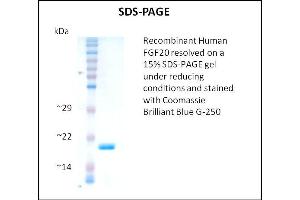 SDS-PAGE (SDS) image for Fibroblast Growth Factor 20 (FGF20) (Active) protein (ABIN5509482)