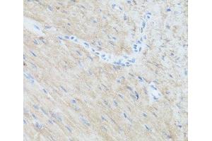 Immunohistochemistry of paraffin-embedded Mouse heart using CLUH Polyclonal Antibody at dilution of 1:100 (40x lens). (CLUH anticorps)