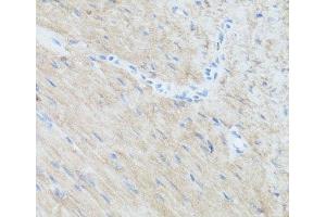 Immunohistochemistry of paraffin-embedded Mouse heart using CLUH Polyclonal Antibody at dilution of 1:100 (40x lens). (CLUH anticorps)