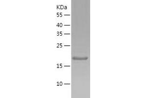 Western Blotting (WB) image for MRG-Binding Protein (MRGBP) (AA 1-204) protein (His-IF2DI Tag) (ABIN7124025)