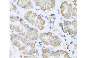 Immunohistochemistry of paraffin-embedded Human stomach using L2HGDH Polyclonal Antibody at dilution of 1:100 (40x lens). (L2HGDH anticorps)