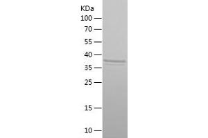 Western Blotting (WB) image for Twist Homolog 1 (Drosophila) (TWIST1) (AA 1-103) protein (His-IF2DI Tag) (ABIN7125567)