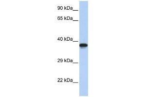 WB Suggested Anti-DMRTC2 Antibody Titration:  0. (DMRTC2 anticorps  (N-Term))